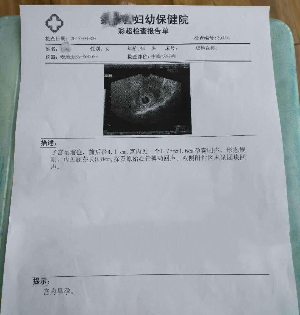 助孕