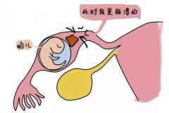 Թܻйе