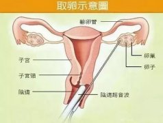 ԹӤȡʹ